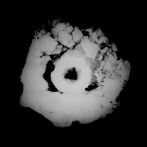 x-ray of a candlestick base