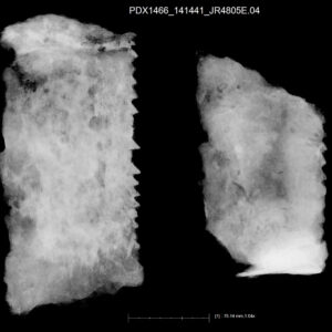 An X-ray of two saw blade fragments found inside the Governor's Well